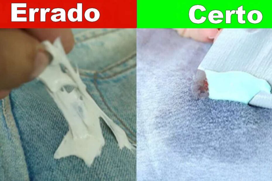 como remover chiclete